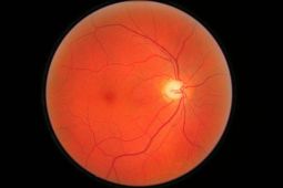 szemfenékvizsgálat pupilla tágítás nélkül, diabétesz szűrés, látásvizsgálat, szemész szakorvos - STYLE OPTIKA SZEMÜVEG NAPSZEMÜVEG ÉS KONTAKTLENCSE SZALON BUDAPEST